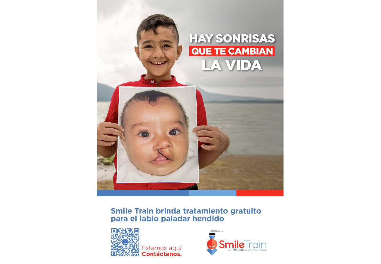 Smile Train lanzó su primera campaña de concientización sobre labio y paladar hendido